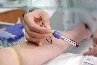 看牙料要验血吗,看牙前需验血？揭秘牙科治疗前的血液检查必要性